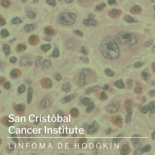 Información sobre Linfoma de Hodgkin San Cristóbal Cancer Institute